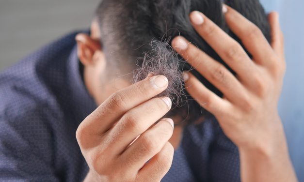 Hair Loss After Travelling: What You Can Do